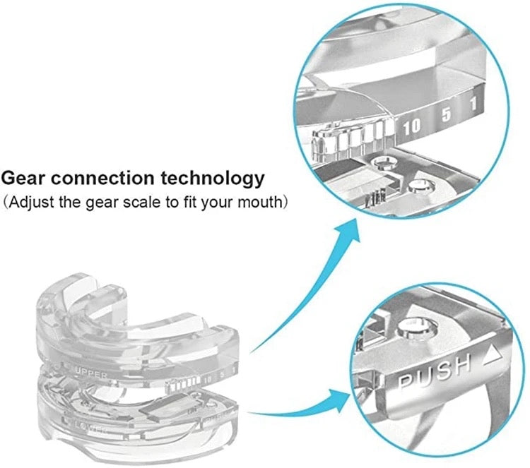 Anti Snoring Mouthpiece