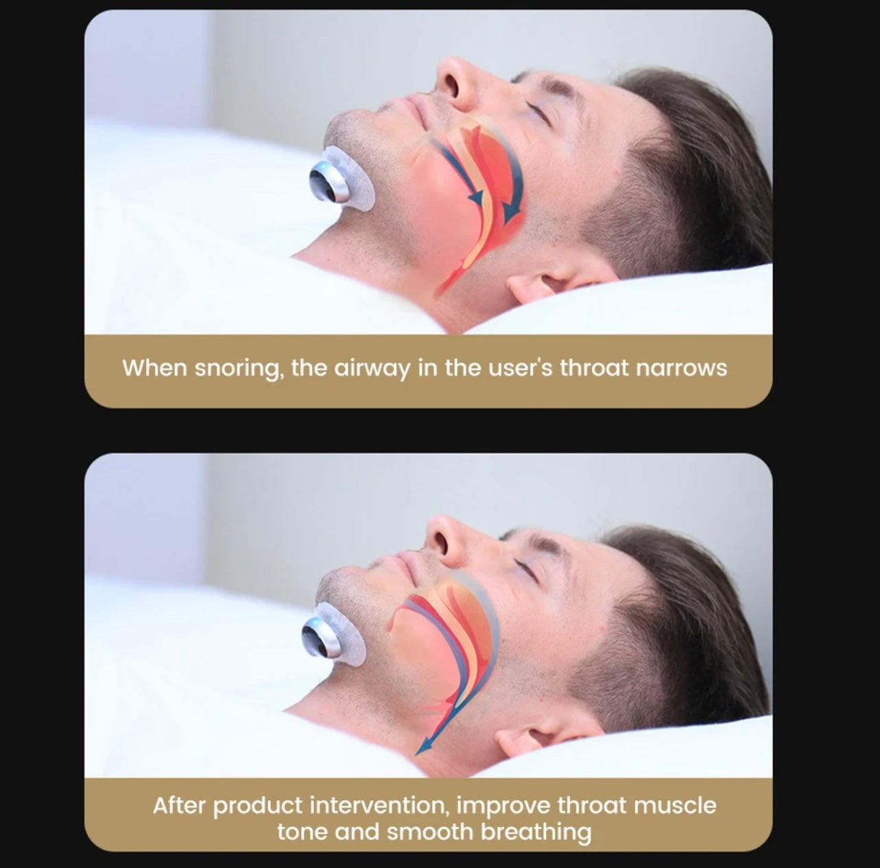 Smart Snore Stopper