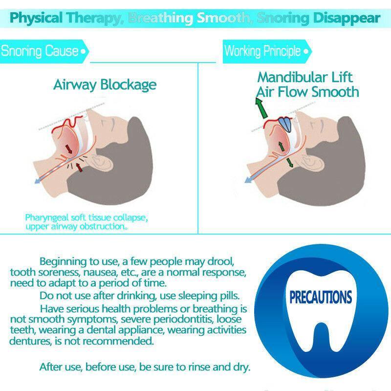 SnoreAway Mouthpiece - Pain Free Me